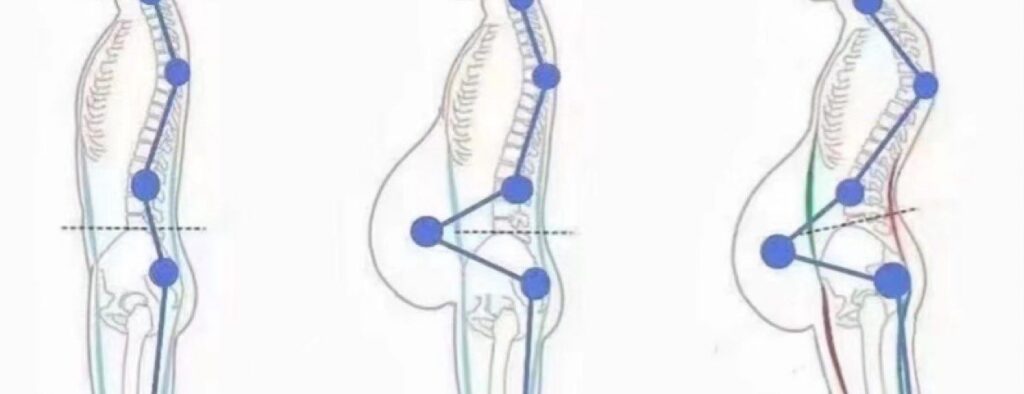 Postnatal Abdominal Separation Recovery