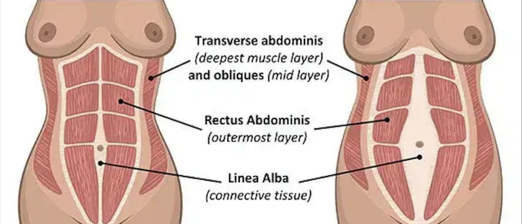 Physio for Abdominal Separation